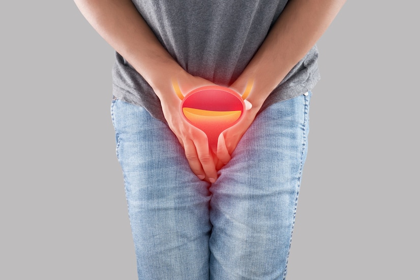 herpes genital
